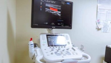 Photo of Nuevo ecógrafo para estudios cardiológicos en el Hospital Regional Río Grande